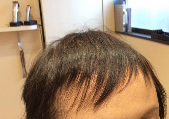 抗がん剤治療の影響で前髪の伸びが遅くなってしまったお客さま 福島県郡山市の 大人のヘアデザイン 髪質改善 増毛ボリュームエクステ 特化美容室 プールブー オリジン ｐｏｕｒｖｏｕｓ Origin